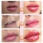 Derol Day and Night Lip Plumper Pro 2